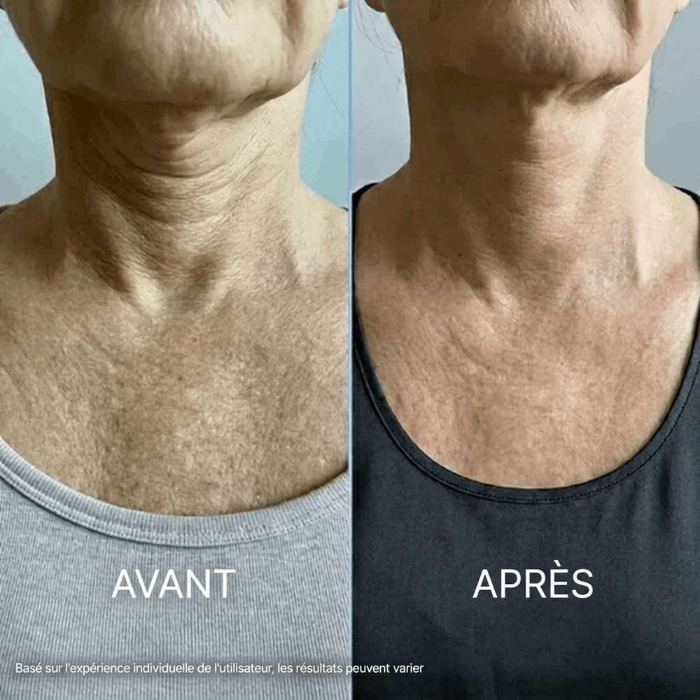 Crème Cou Raffermissante Tensilis™