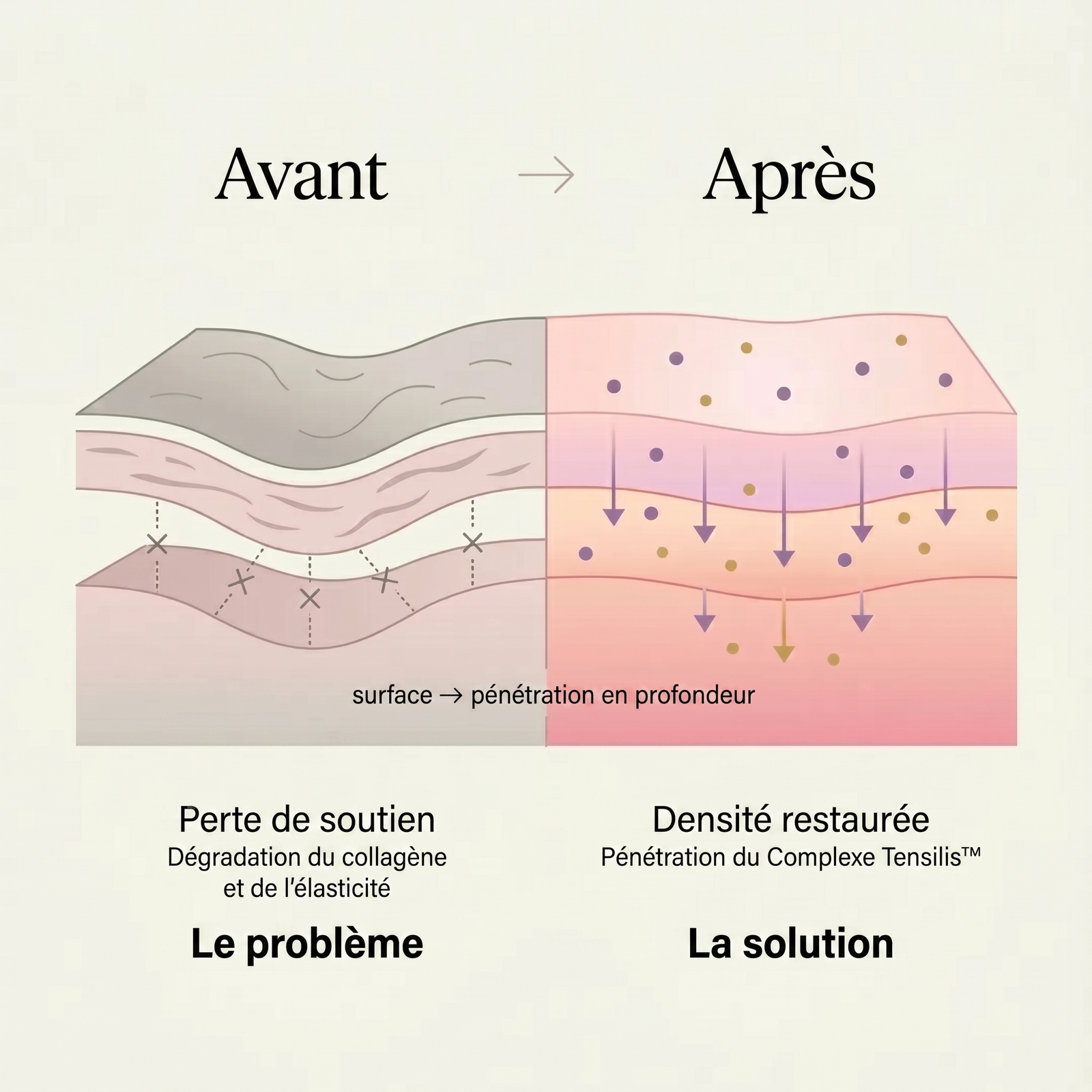 Avant / après — le problème et la solution