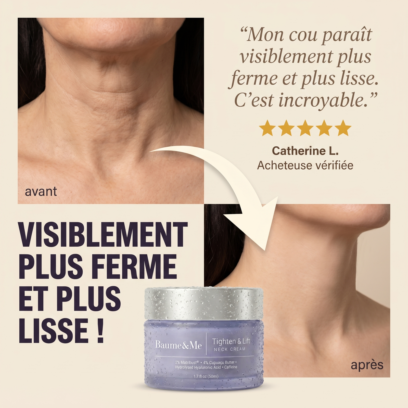 Un cou visiblement plus ferme et plus lisse — avant / après