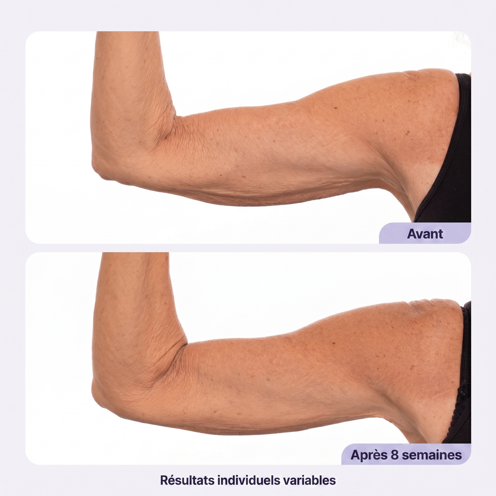 Crème Bras Raffermissante — visuel 2