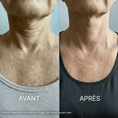 Crème Cou Raffermissante Tensilis™